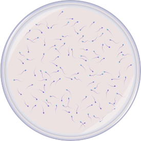 low-sperm-count